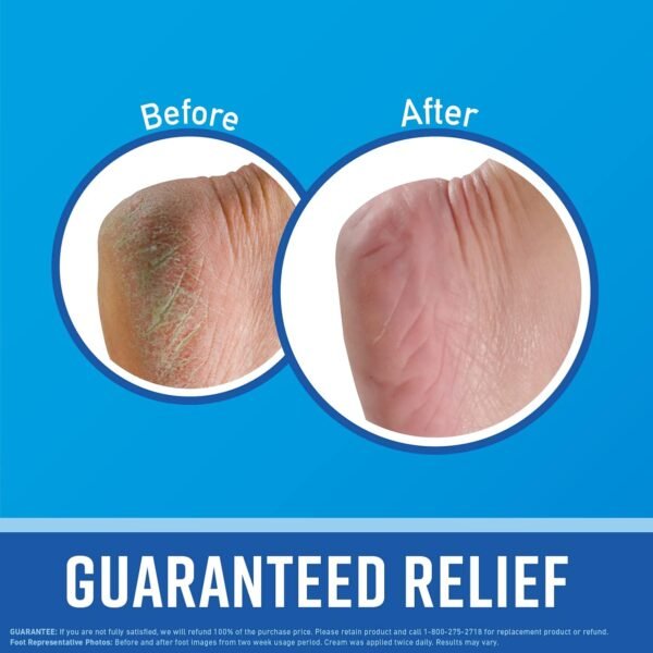 O'Keeffe's for Healthy Feet
