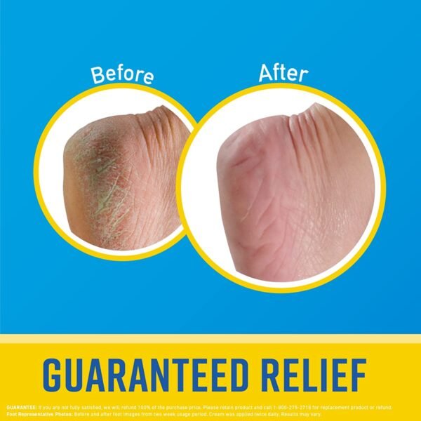 O'Keeffe's Skin Repair Body Lotion and Dry Skin Moisturizer